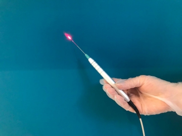 Eliminación de Varices o Arañitas