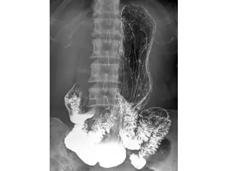 Equipo Radiográfico Digital Gastrointestinal