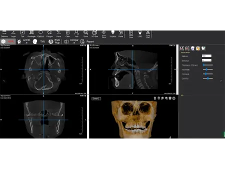 Equipo de Tomografía Cone Beam 3D