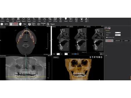Equipo de Tomografía Cone Beam 3D
