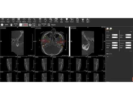 Equipo de Tomografía Cone Beam 3D