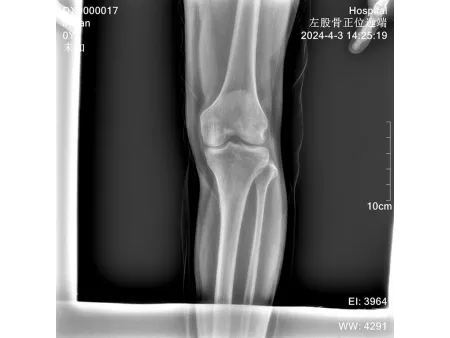 Equipo de Rayos X, Portátil ANGEL